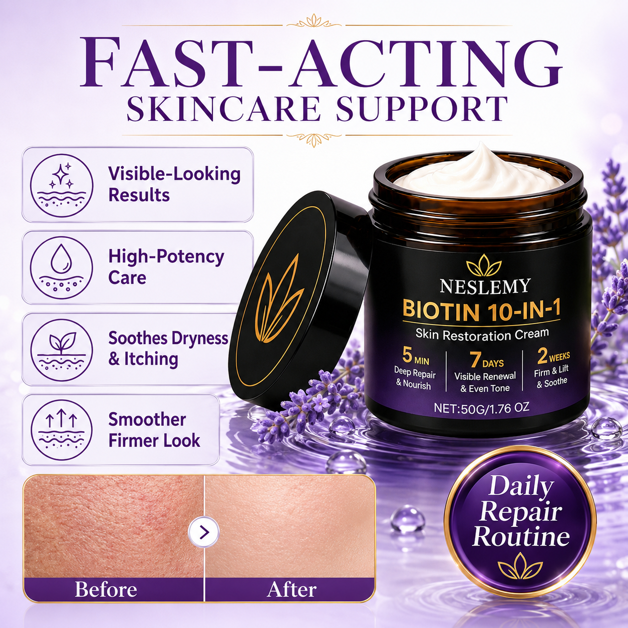 NESLEMY™ Biotin 10-in-1 Skin Restoration Cream Big Sale